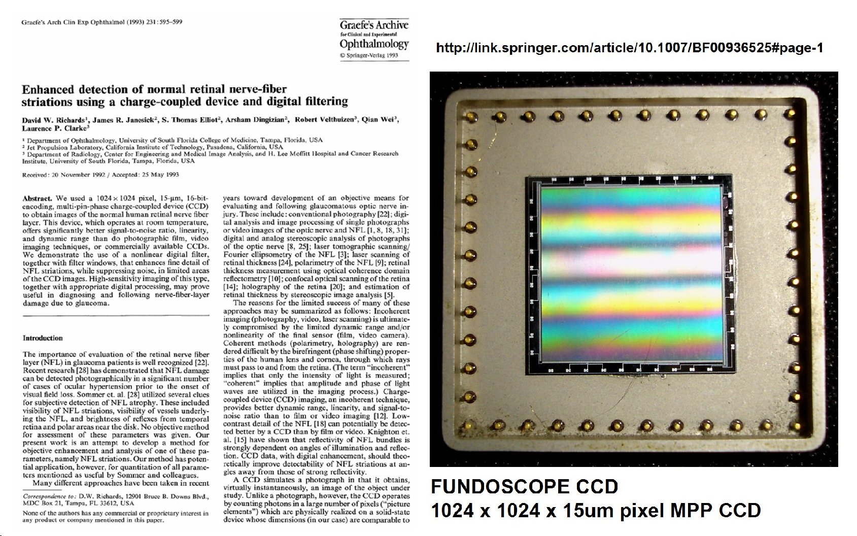 Janesick commercial fundoscope CCD imager